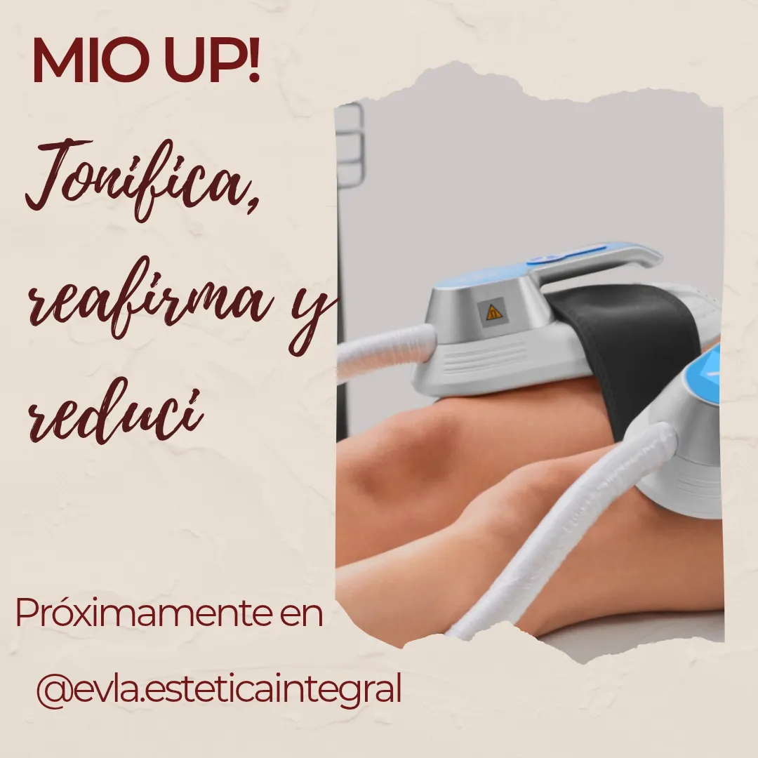 Por que debería hacerme Mio Up?